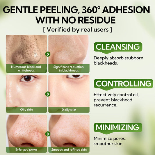 Experience the Power of Upgraded 2.0 Bamboo Charcoal Blackhead Remover Mask - 60 Pcs Peel-Off Nose Strips for Deep Pore Cleansing and Purifying, Perfect for All Skin Types!